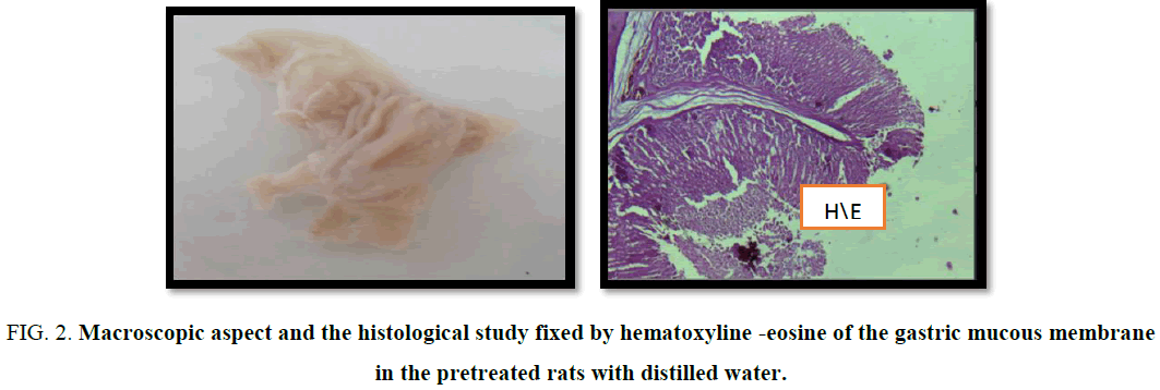 biotechnology-histological-hematoxyline-gastric